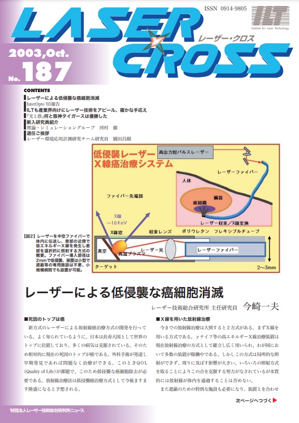 記事 Laser Cross No.187のアイキャッチ画像