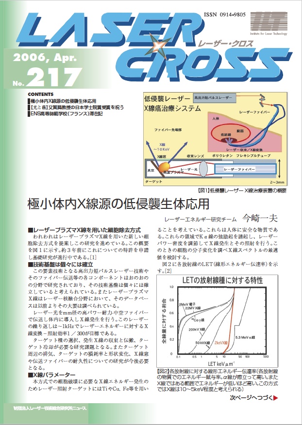 記事 Laser Cross No.217のアイキャッチ画像