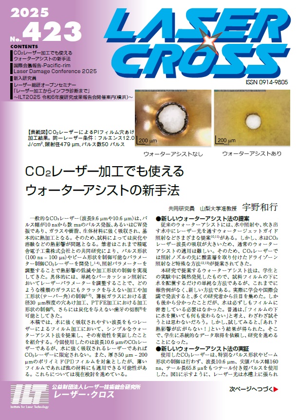 記事 Laser Cross No.423のアイキャッチ画像